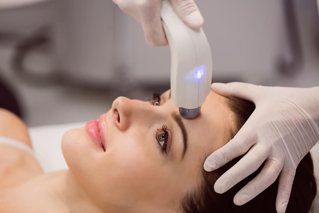 Microneedling with Skin Rejuvenation Peptide Treatment + LED Light Facial