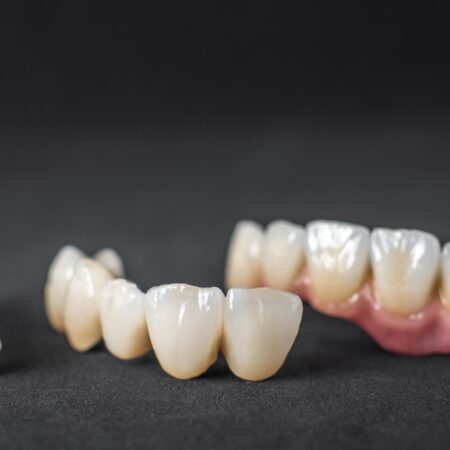 Zirconia