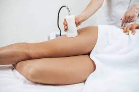 Cellulite Treatment