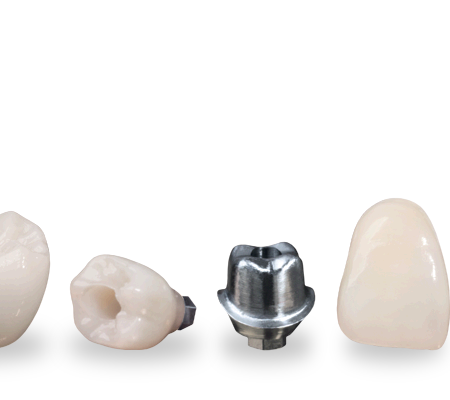 Implants