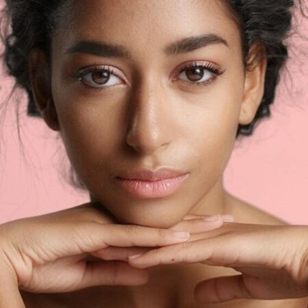 One Ultherapy for Upper Face Including Crows Feet