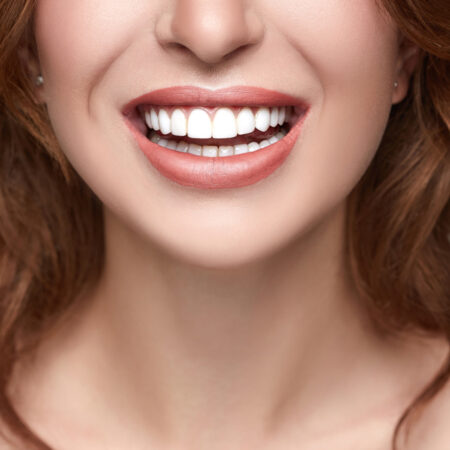 Three In-Office Teeth Whitening Treatments