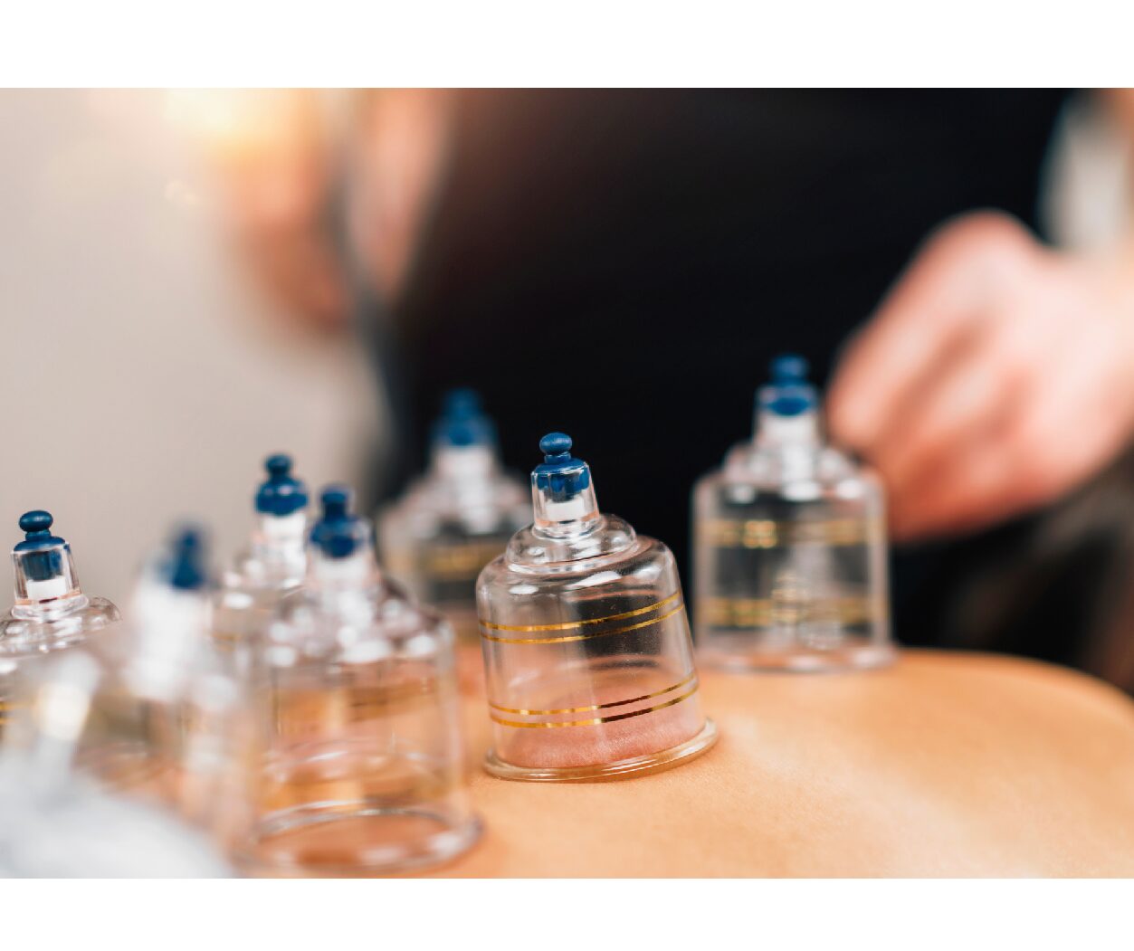 One Butt Cupping Session