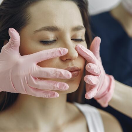 Microneedling with PRP